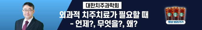 배너