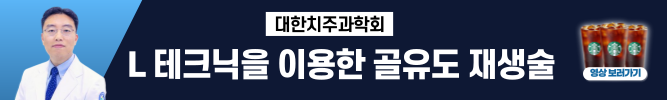배너