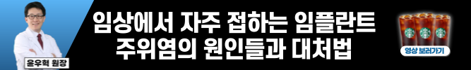 배너