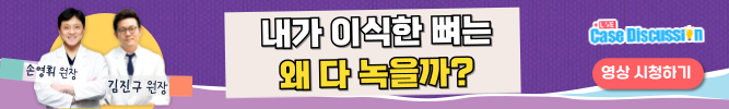 배너