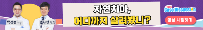 배너