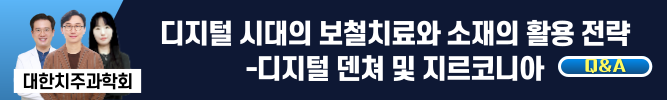 배너