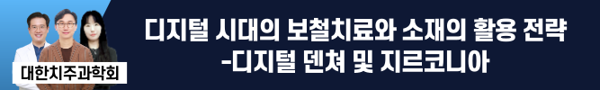 배너