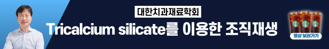 배너