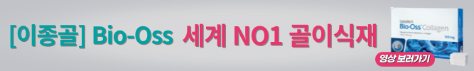 배너