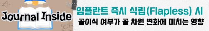 배너