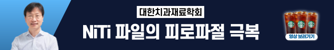 배너