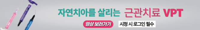 배너