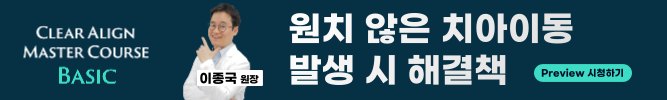배너